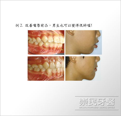 崇民牙醫診所_齒顎矯正_診療項目